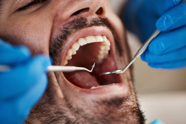 Best Emergency Denture Repair in Burnsville, NC